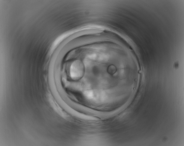 X0000115200862200911251441