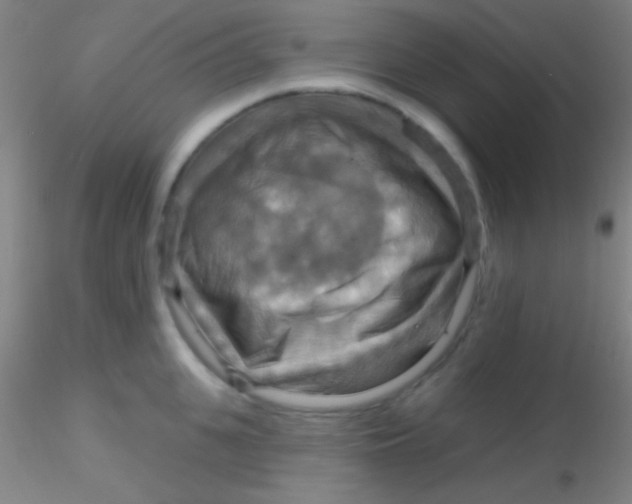 X0000115200951200911251440