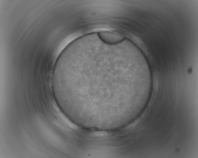 X0000115201186200911251436