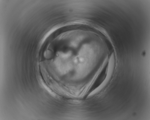 X0000115201235200911251435