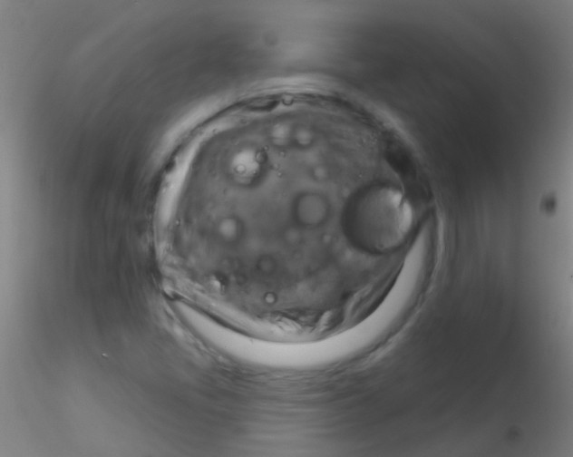 X0000115201405200911251432