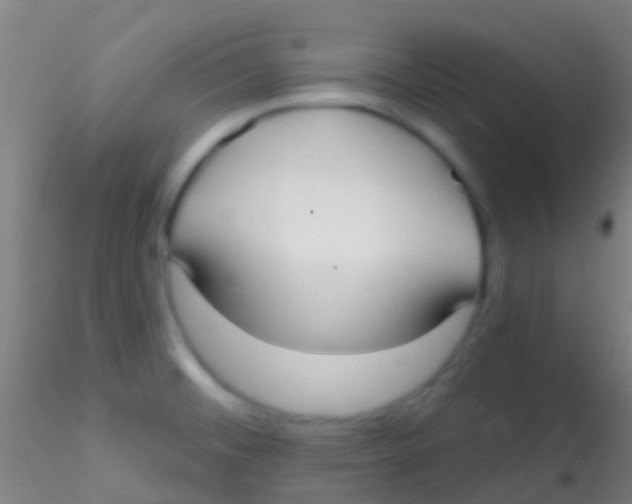 X0000115201476200911251431