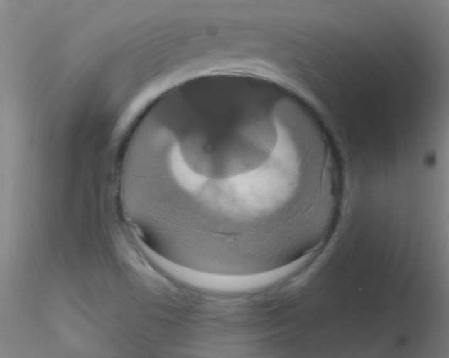 X0000115201506200911251430