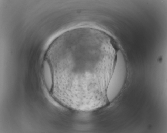 X0000115201519200911251430