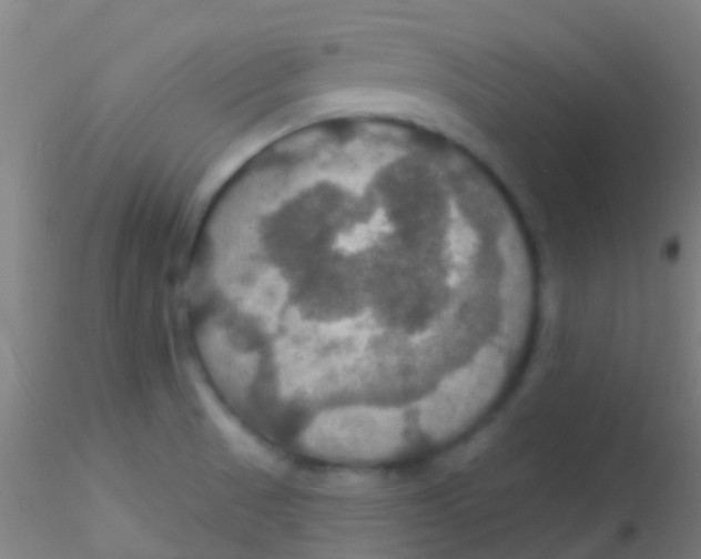 X0000115201521200911251430