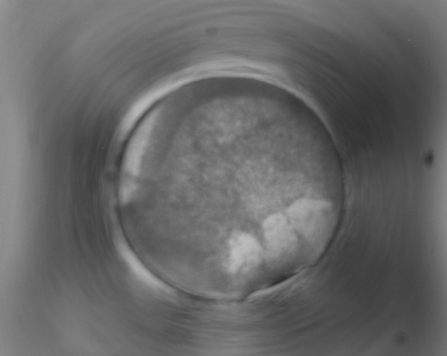 X0000115201531200911251430