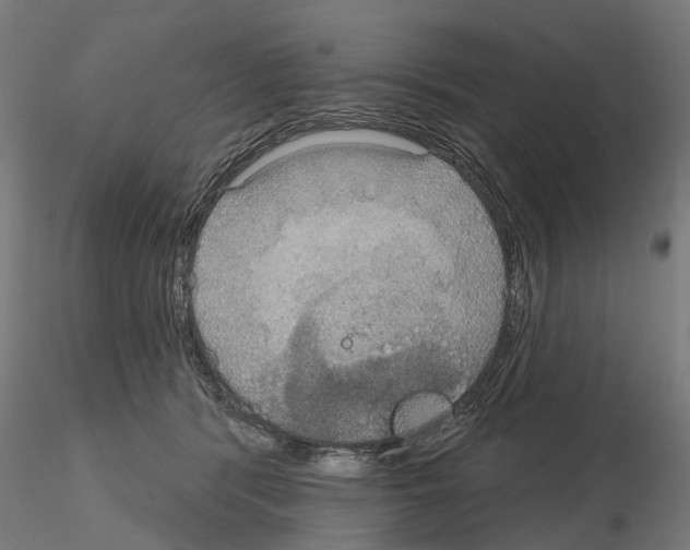 X0000115200416200912091139