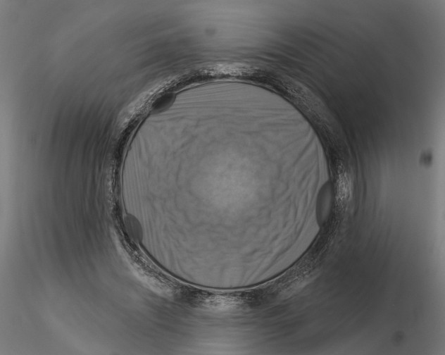 X0000115200444200912091138