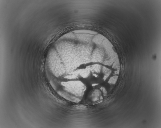 X0000115200462200912091138