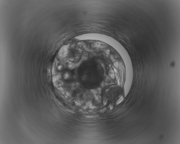 X0000115200527200912091137