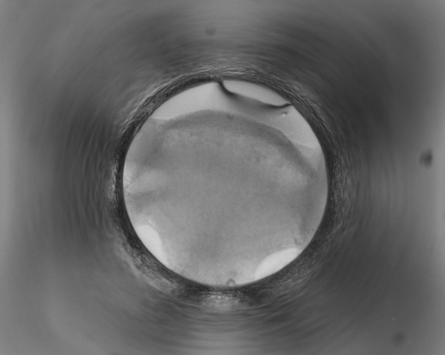 X0000115200596200912091136