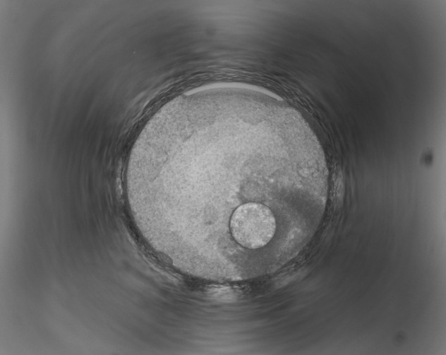 X0000115200616200912091136