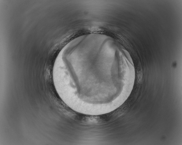 X0000115200618200912091136