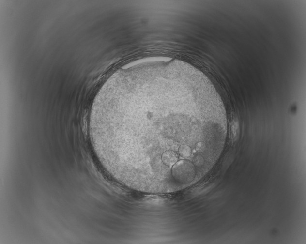 X0000115200620200912091136