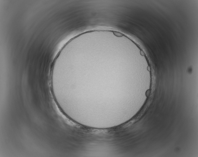 X0000115201006200912091130