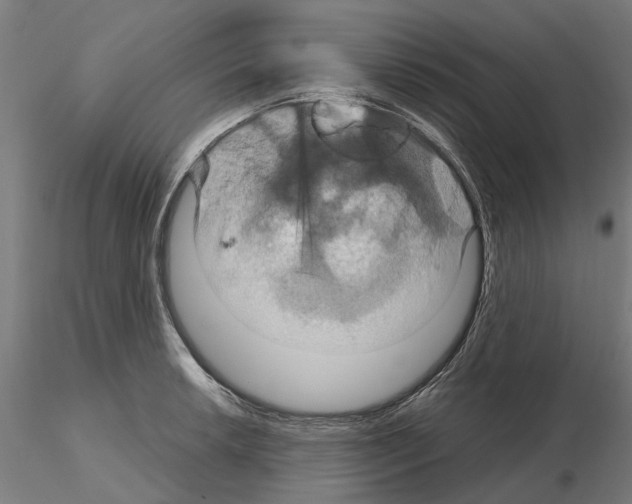 X0000115201042200912091129