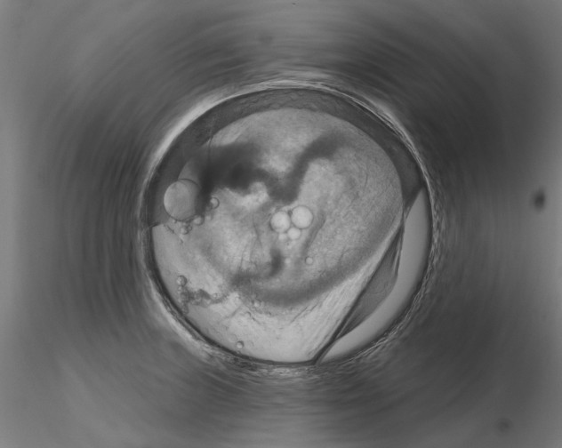 X0000115201235200912091127