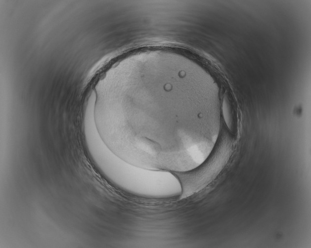 X0000115201314200912091125