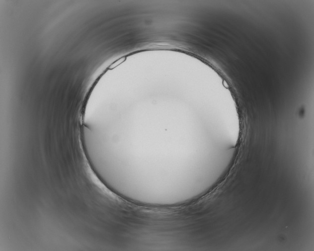 X0000115201476200912091122