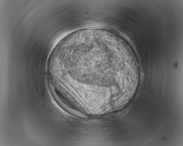 X0000115201487200912091122
