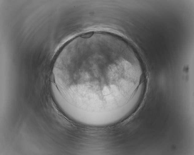X0000115201505200912091122