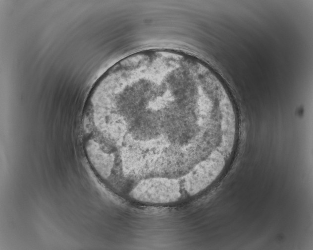 X0000115201521200912091122