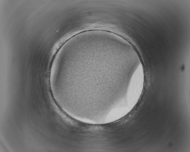 X0000115201525200912091122
