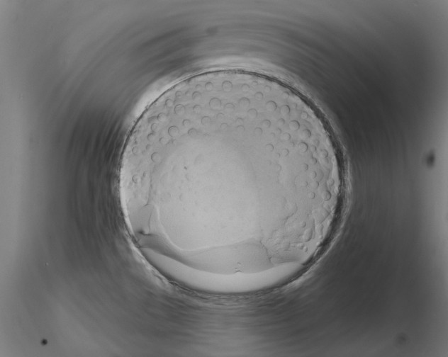 X0000115201529200912091122