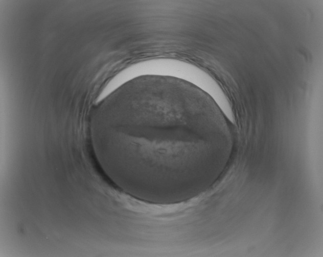 X0000115210035200911121913