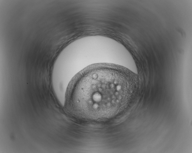 X0000115210416200911121908