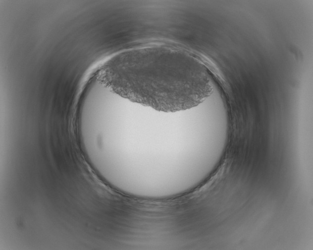 X0000115211172200911121858