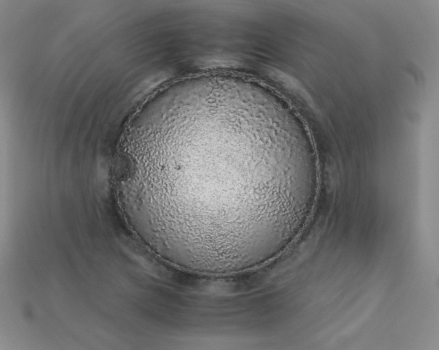 X0000115211217200911121857