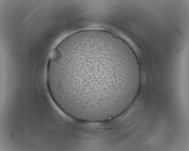 X0000115211479200911121854