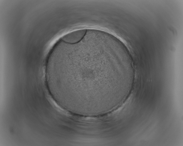 X0000115211503200911121853