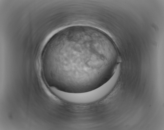 X0000115211515200911121853