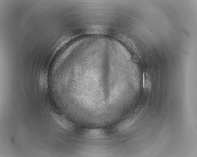 X0000115210204200911181535