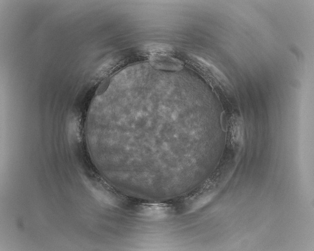 X0000115210316200911181533