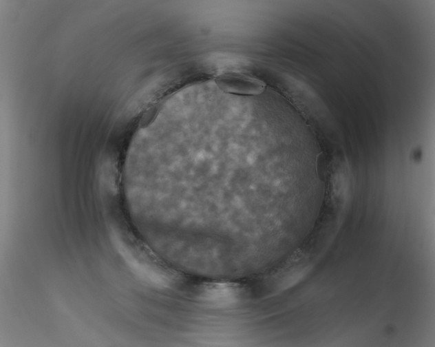 X0000115210316200911251514