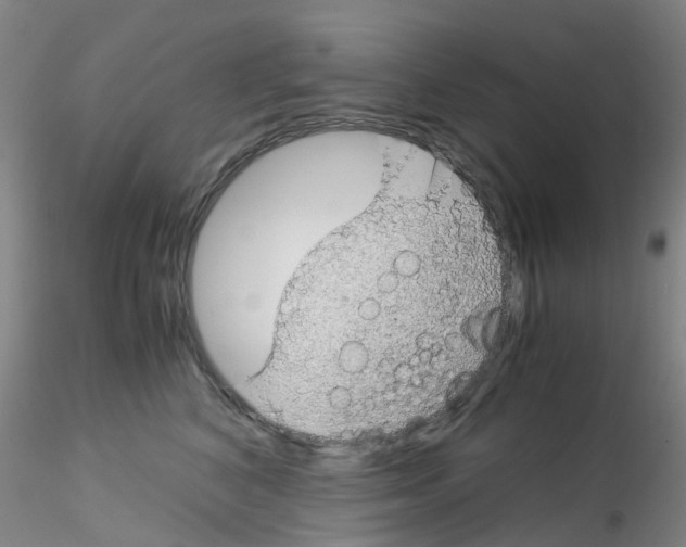 X0000115210616200911251509