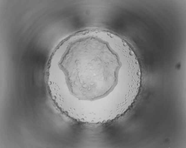 X0000115210856200911251506