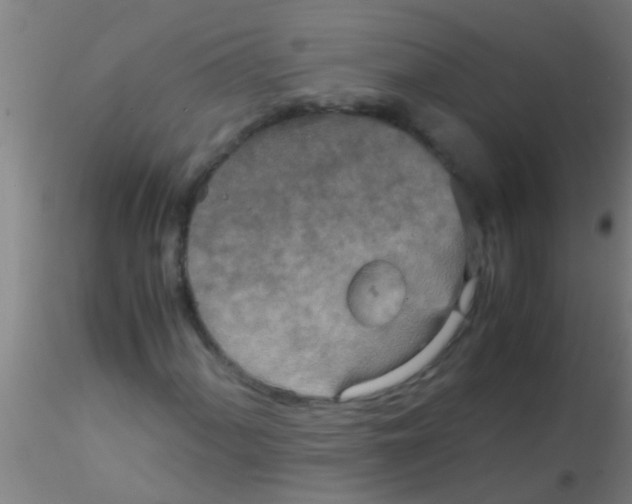 X0000115211060200911251502