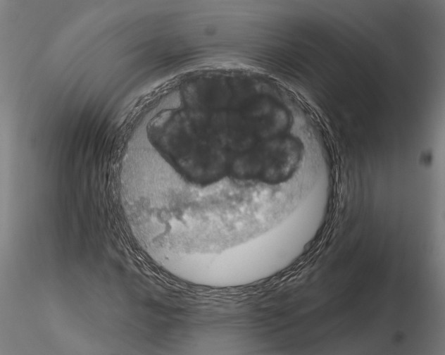 X0000115211016200912091153