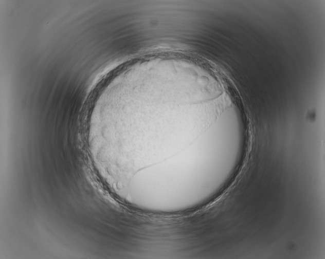 X0000115211018200912091153