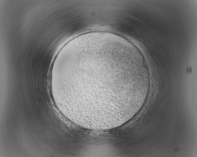 X0000115211056200912091153