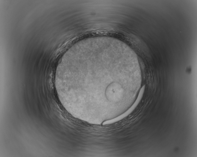 X0000115211060200912091153