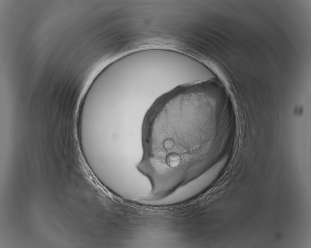 X0000115211104200912091152