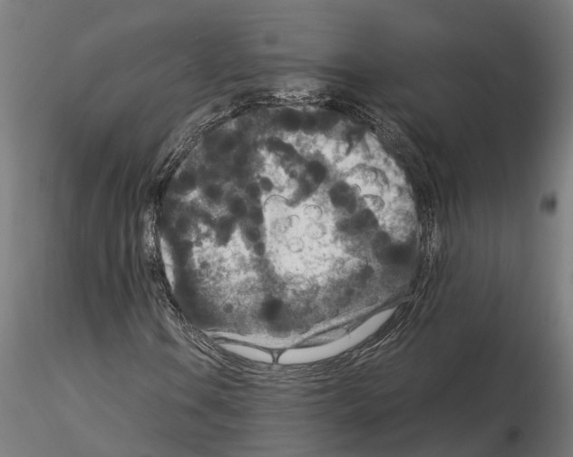 X0000115211106200912091151