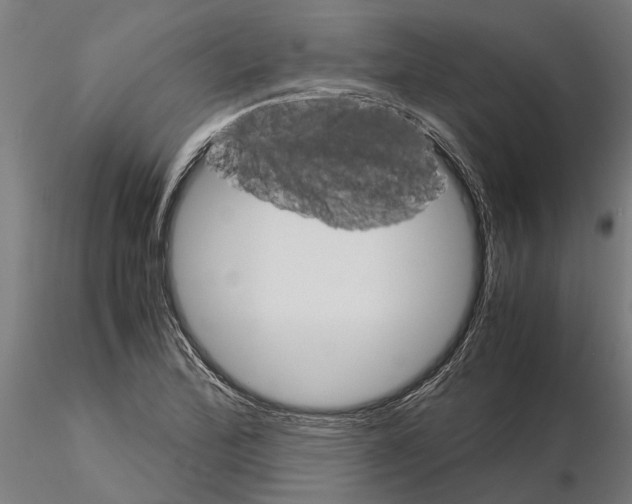 X0000115211172200912091151