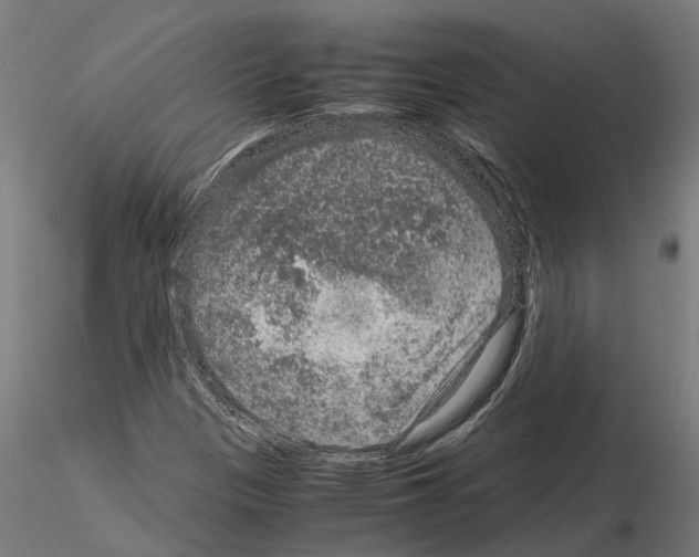 X0000115211305200912091149