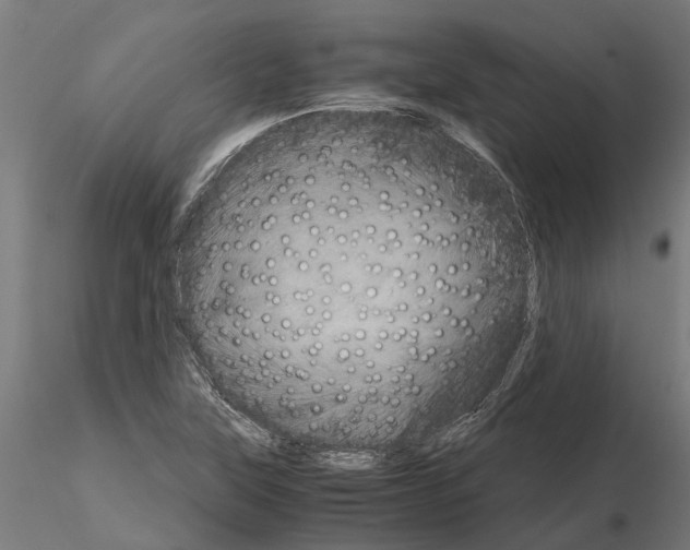 X0000115211315200912091149